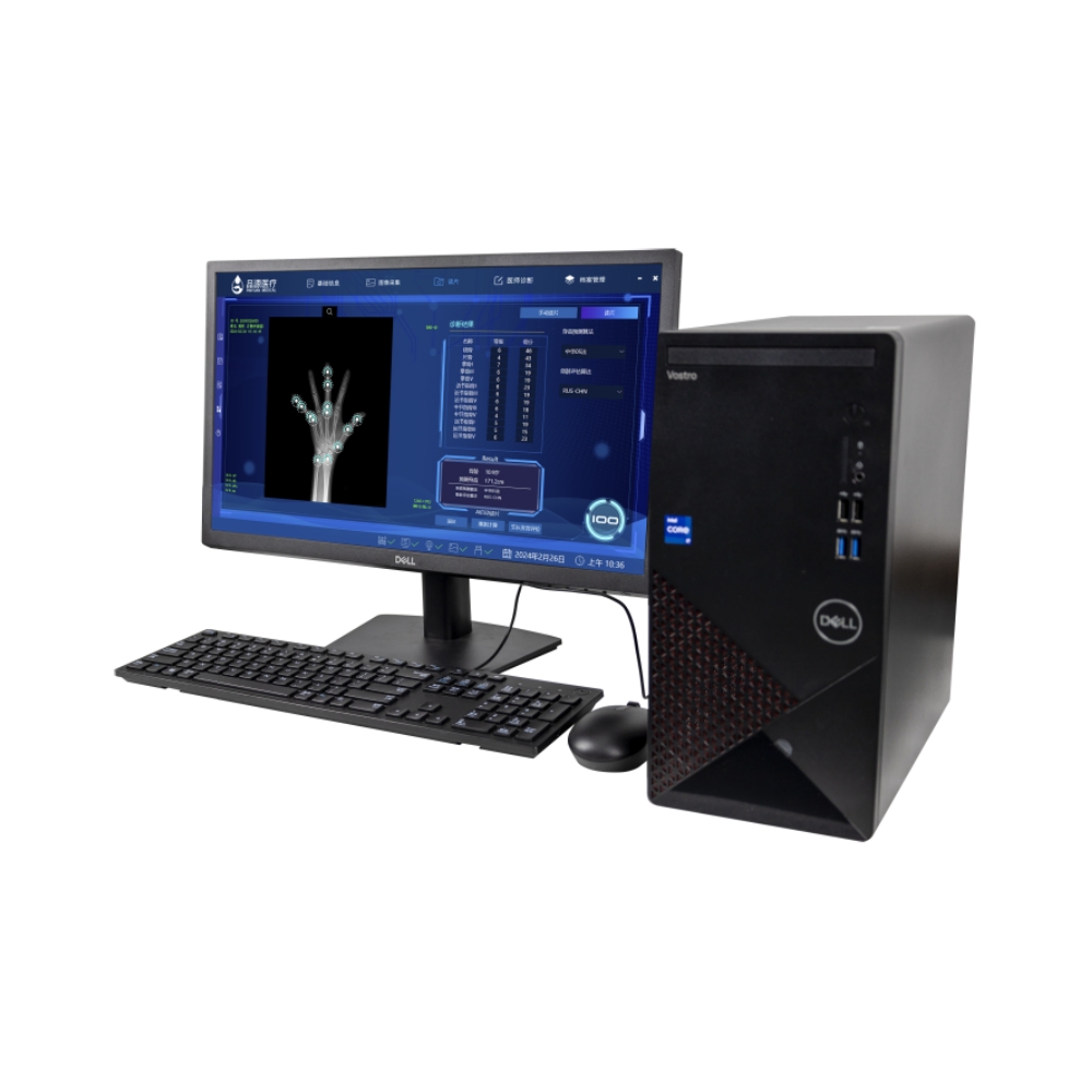 X射线骨龄仪BAD-Q1