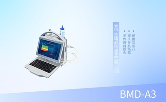 便携式超声骨密度仪